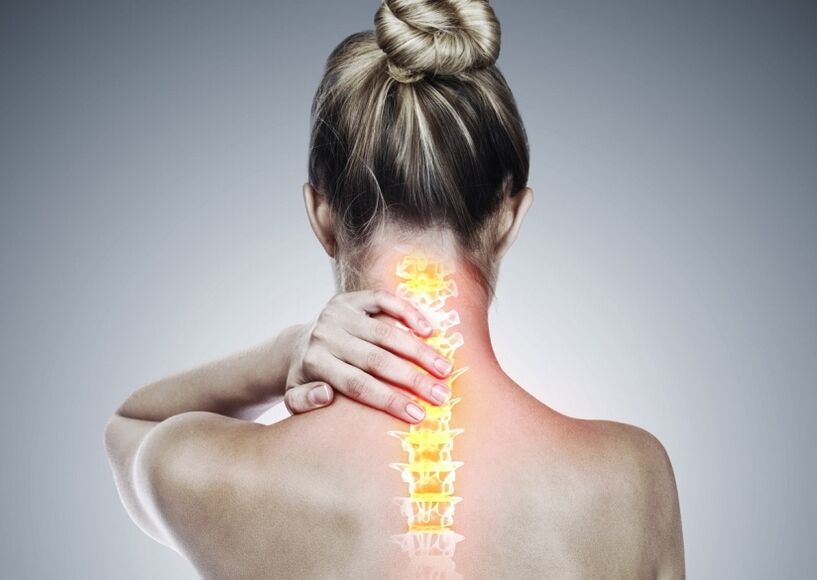 Osteochondroză