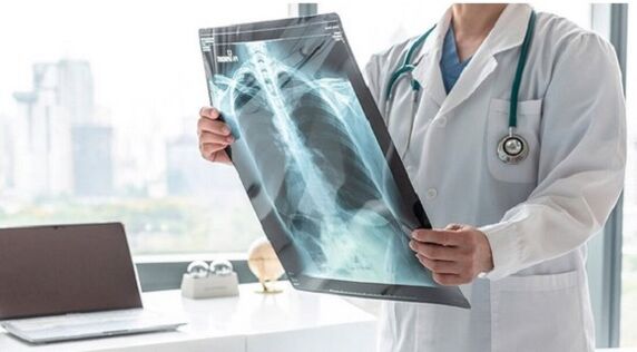 Diagnosticare cu raze X pentru durerea sub omoplatul stâng