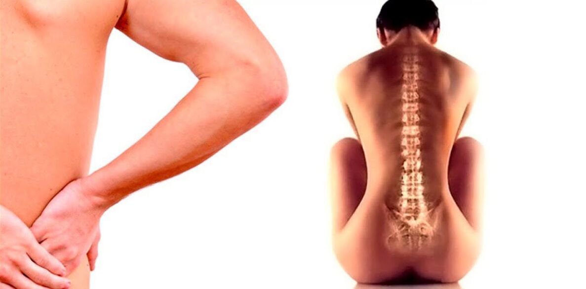 dureri de spate din cauza osteocondrozei