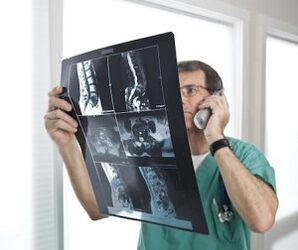 Mielografie pentru diagnosticul de osteocondroză și hernii intervertebrale